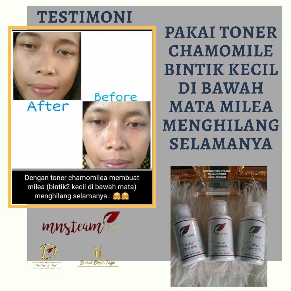 Toner Wajah SR12 | Acne Toner SR12 &amp; Toner Chamomille SR12 | Pembersih Wajah SR12 Skincare Solusi Jerawat