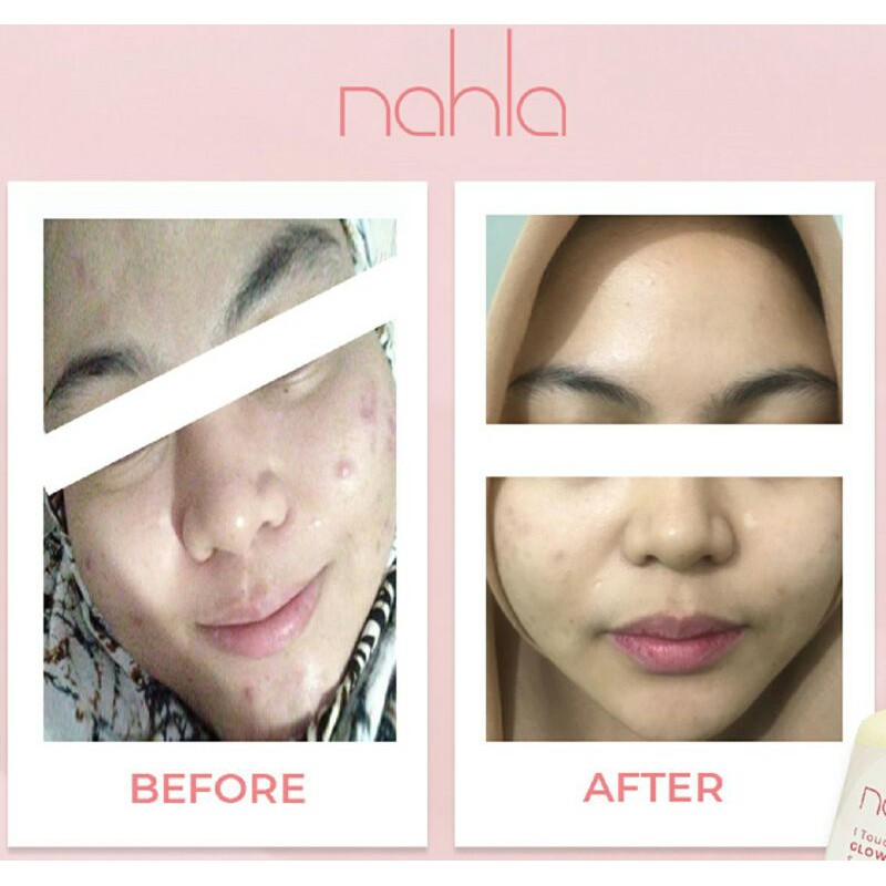 serum glowing, serum jerawat, serum untuk kulit sensitif, serum halal, serum BPOM