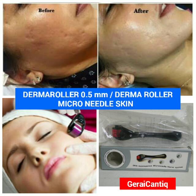 DERMAROLLER 0.5 mm / DERMA ROLLER MICRO 540 NEEDLE SKIN