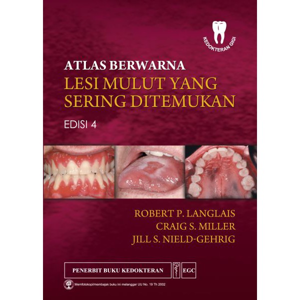 Atlas Berwarna Lesi Mulut yang Sering Ditemukan Edisi 4 [ORIGINAL]