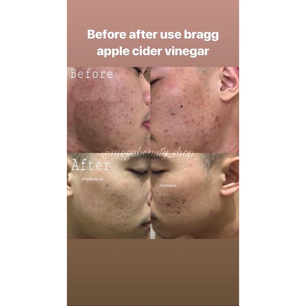 

BRAGG Apple cider Vinegar 946ml PROMO