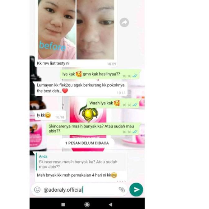 ۝ Adoraly skincare Original skincare paling glow adoraly skincare jakarta adoraly jakarta asli adora