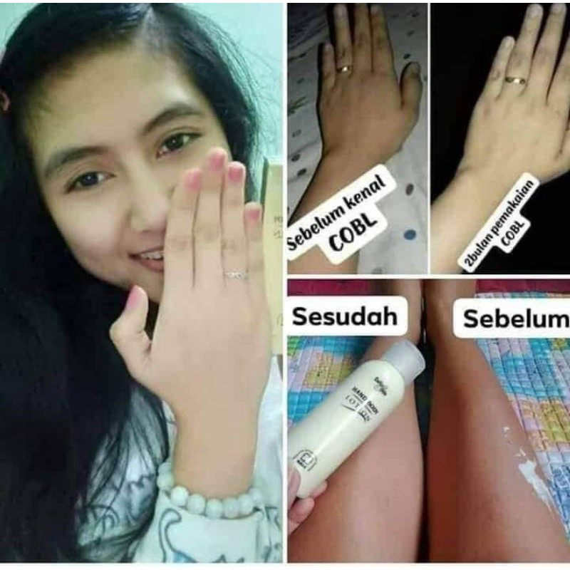 

COBLPENCERAHKULIT