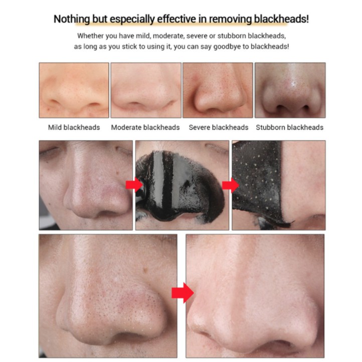 LANBENA KOMEDO MASK STRIPS LANBENA SACHET / DEEP CLEANSING NOSE STRIPS MASKER