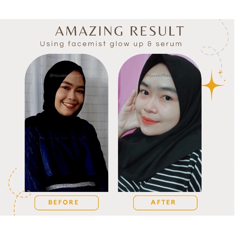 【Official Outlet】 NEW SKIN YOUTH REVOLUTION PLUS SERUM WAJAH GLOWING BRIGHTENING FRESH CALMING SERUM GLOW UP WITH CHROMABRIGHT NIACINAMIDE ALPHA ARBUTIN VIT C | PEMUTIH PENCERAH KULIT WAJAH GLOWING PUTIH BERSIH ALAMI VIRAL BPOM