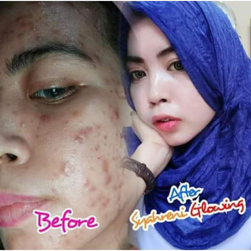 BISA COD BPOM PAKET LENGKAP SYAHRENI GLOWING SYR SYAHRAENI SET ORI PREMIUM KRIM SIANG WAJAH BEAUTY-4