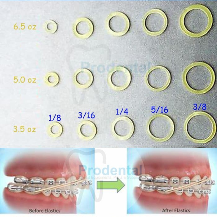 Karet elastik gigi ortho behel dental rubber band elastis karet elastic oz kawat gigi renggang eceran