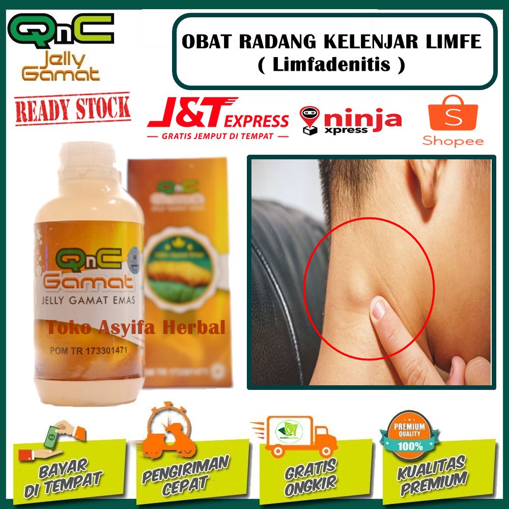 Jual Obat Radang Kelenjar Limfe Limfadenitis Kelenjar Tiroid