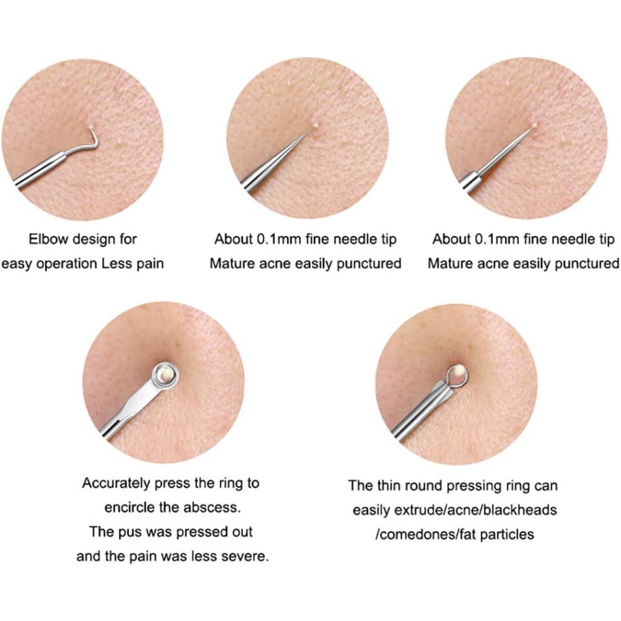 Alat Pinset Facial Pencetan Jerawat Komedo Acne Removal Remover 4Pcs