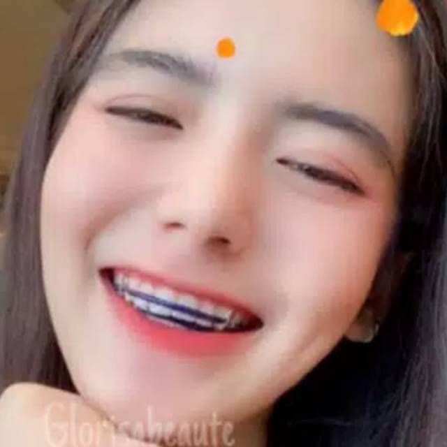 ❤️[ BEHEL GIGI ] Behel Lepas Pasang/ BEHEL THAILAN / BEHEL TAILAN / Behel thailan / behel tailan