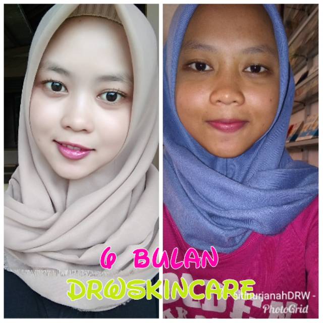sitinurjanahdrwskincare