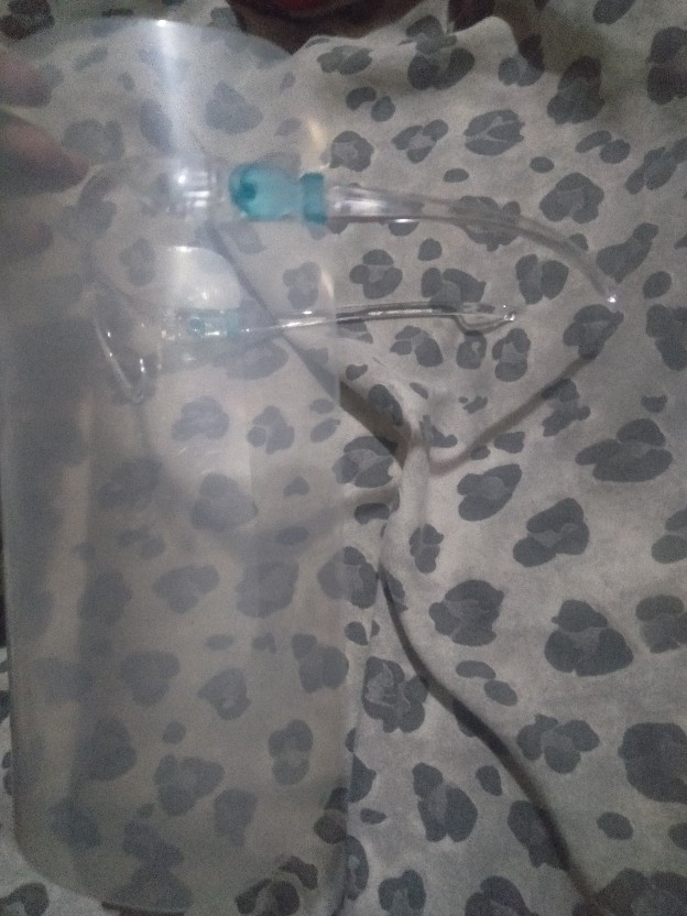 Face Shield Medis Apd Pelindung Wajah Kacamata Anti Fog