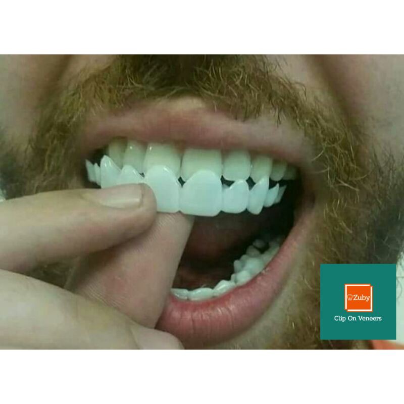 Clip On Veneers/Veneer Lepas Pasang