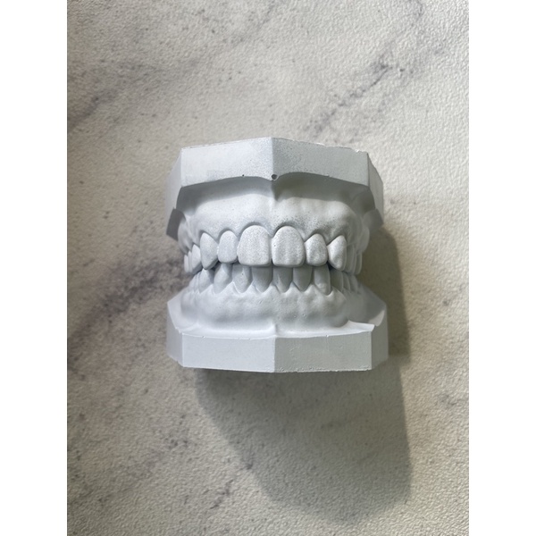 model gigi model rahang model study studi gipsum untuk skill lab praktikum
