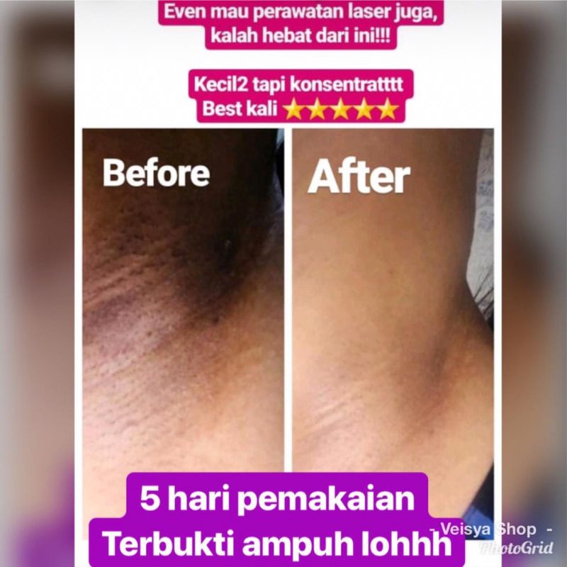 Pemutih Ketiak BABY WHITENING Cream Pemutih Shinkurim Original BPOM