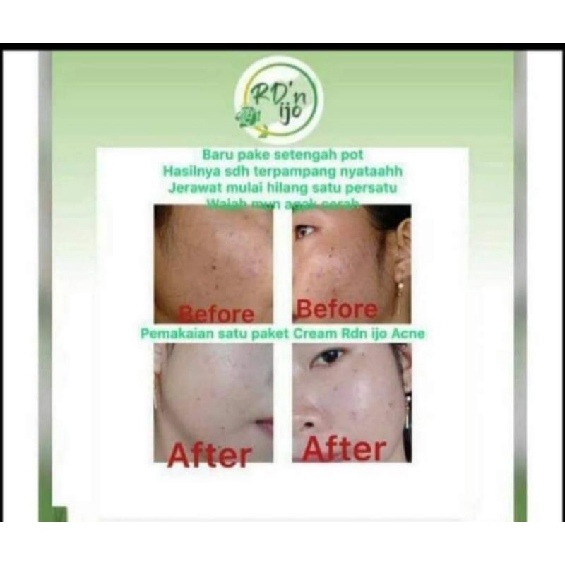 Pemutih Sultan Cream 2in1 Rdn Ijo