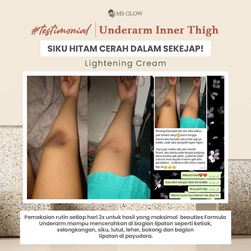 UNDERARM MSGLOW KRIM LIPATAN HITAM MS GLOW