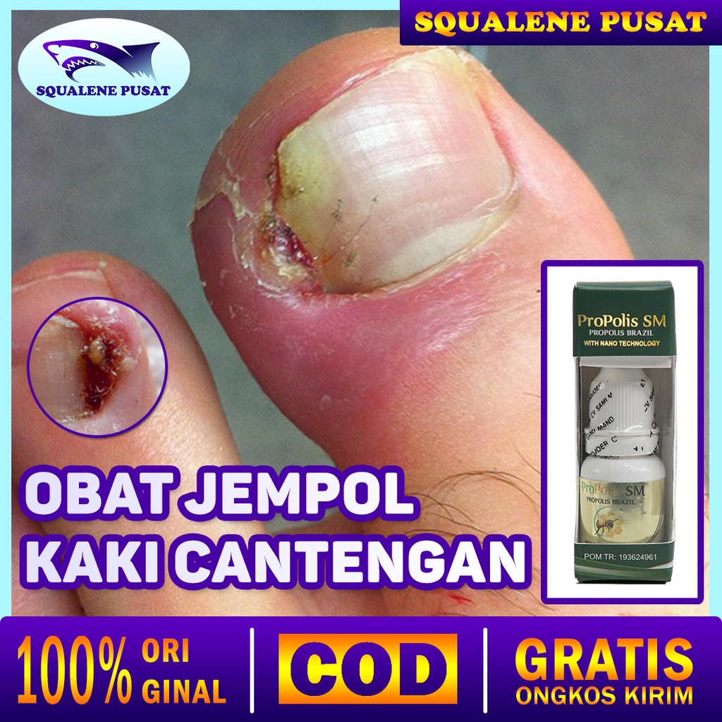 Patah Tulang Kanak Kanak Columbia Asia Hospital Malaysia