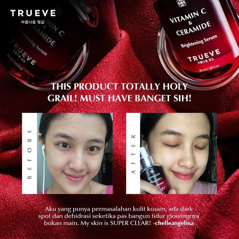 TRUEVE Ultimate Drops of Brightening Serum (Serum Vit C | Pemutih Wajah | Penghilang Bekas Jerawat)