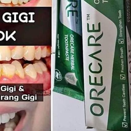 ☟ ODOL TIENS PEMUTIH GIGI & PEMBERSIH KARANG GIGI | TIENS TOOTH PASTE | GIGI PUTIH ℗