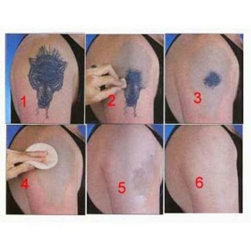 Image of (GROSIR) Tatonox Obat Penghilang Tato 100% Original #2