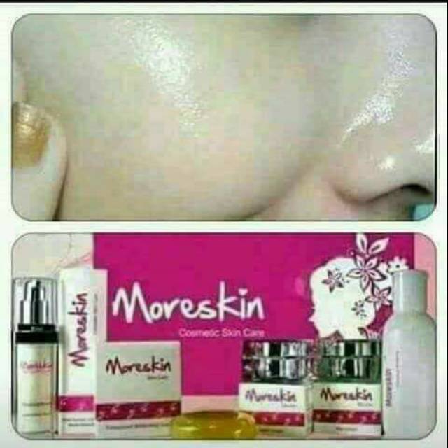

Skinset