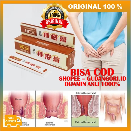 Salep Herbal Wasir Salep Obat Herbal Cina Membantu Mengatasi Wasir/Ambeien ORIGINAL