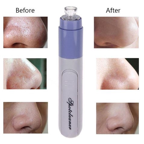 Facial PORE CLEANER/Ampuh Pembersih Komedo