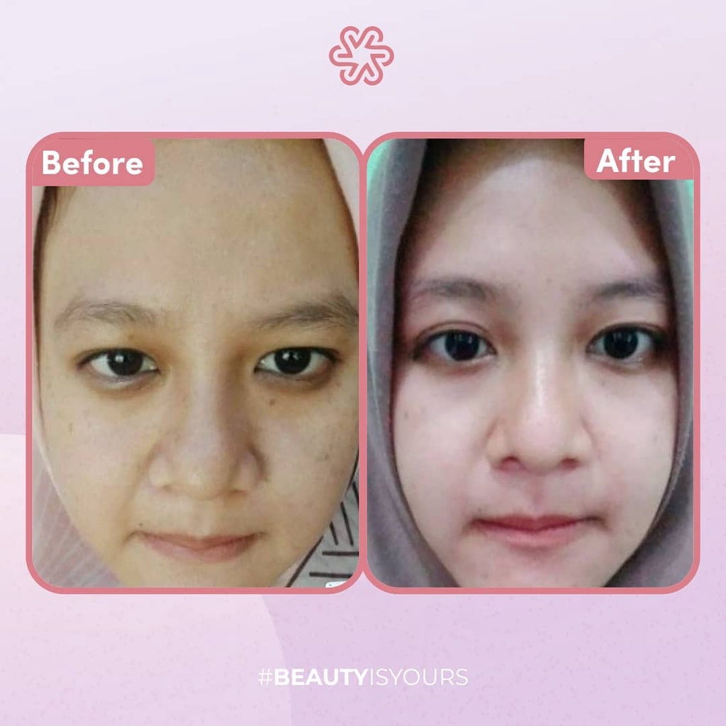 Paket Reguler isi 4 Justmine Beauty Skincare Glowing Acne Jelly Remove Spots Acne More Original BPOM | Paket Cream Wajah