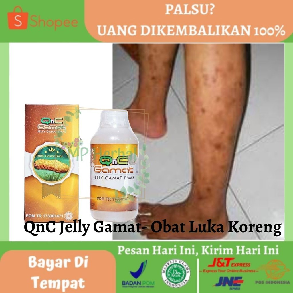 Obat Luka Bekas Koreng Obat Herbal Luka Koreng Obat Koreng Di Kaki Qnc Jelly Gamat 