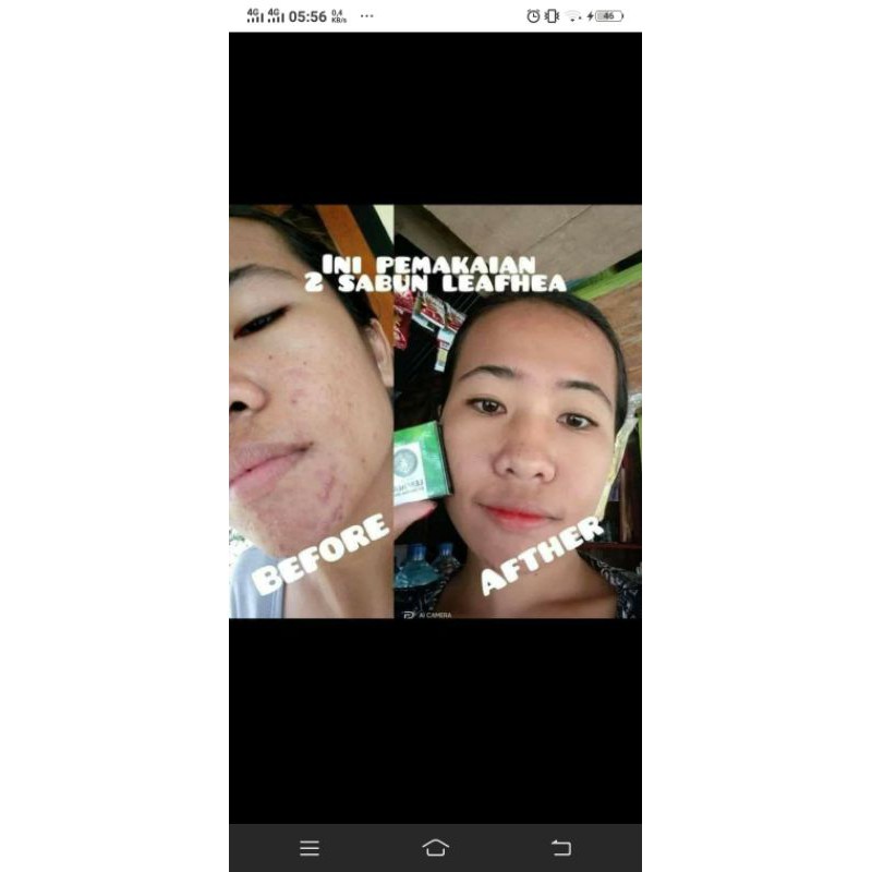 Sabun Leafhea 100% ORI