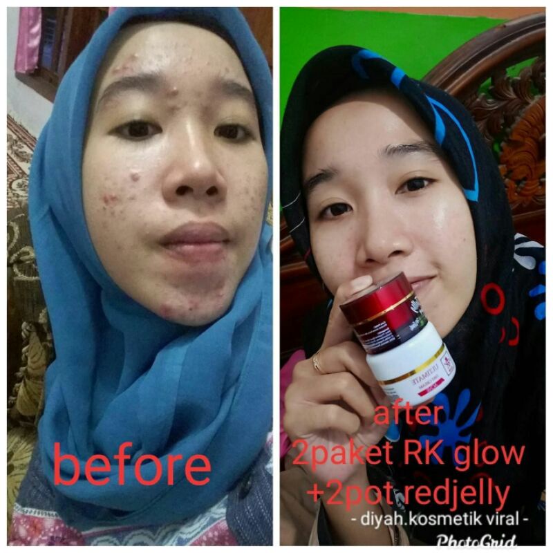 RK Glow Skincase Glowing