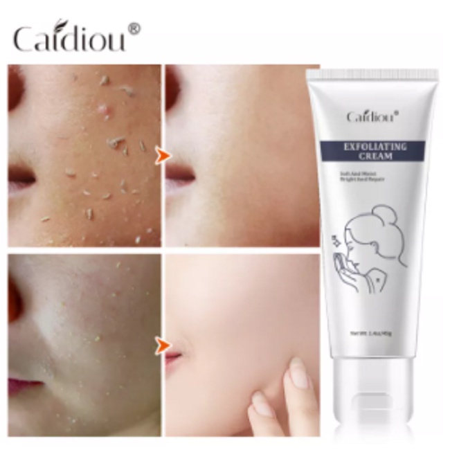 Perawatan Kulit Wajah Exfoliating Cream Whitening Caidiou Exfoliating