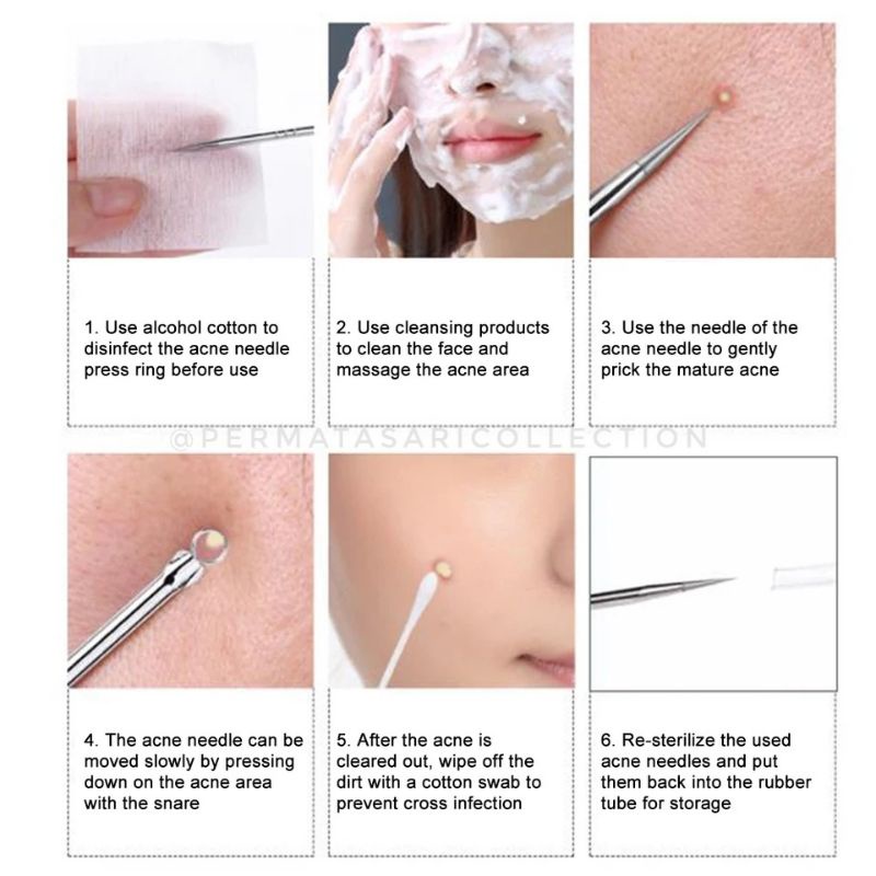 Alat Pebcabut Pinset Pencetan Jerawat Komedo 2 3 Set Acne Removal Remover Face Care Tool Pimple Needle Kit