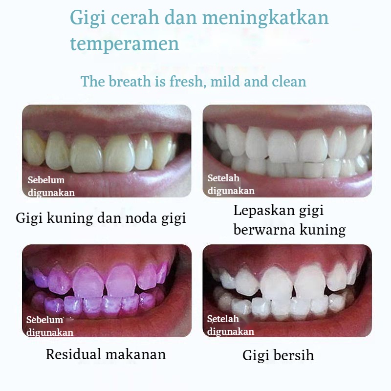 (COD)Obat kumur probiotik nafas segar mulut bersih50ml/350ml Mouthwash Fresh Mint  Obat Kumur Probiotik Nafas segar Pemutih gigi