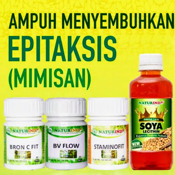 

Solusi Alami & Ampuh Menyembuhkan Epitaksis (Mimisan)