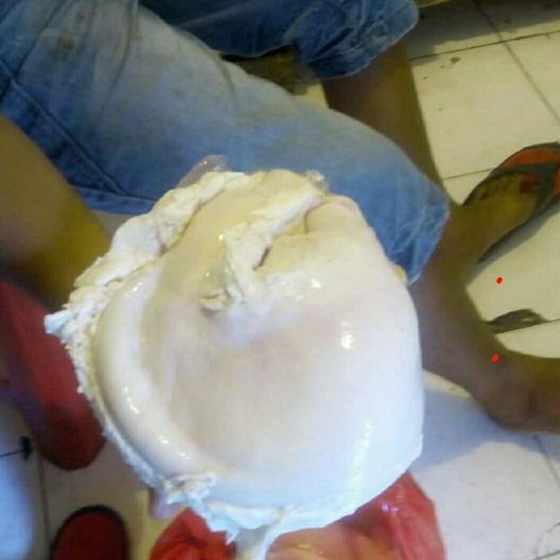 

TITO BABI / CUTU BABI (HARGA SATUAN)