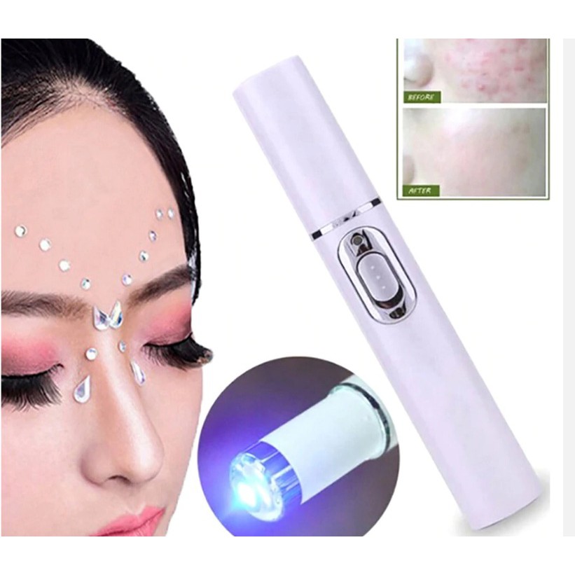 PENA LASER LED OBATI JERAWAT DAN KOMEDO