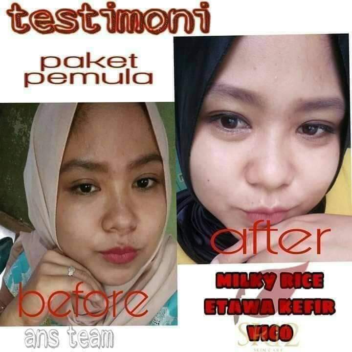 SPOT ESSENCE CREAM SR12 / KRIM SIANG MALAM / FLEK