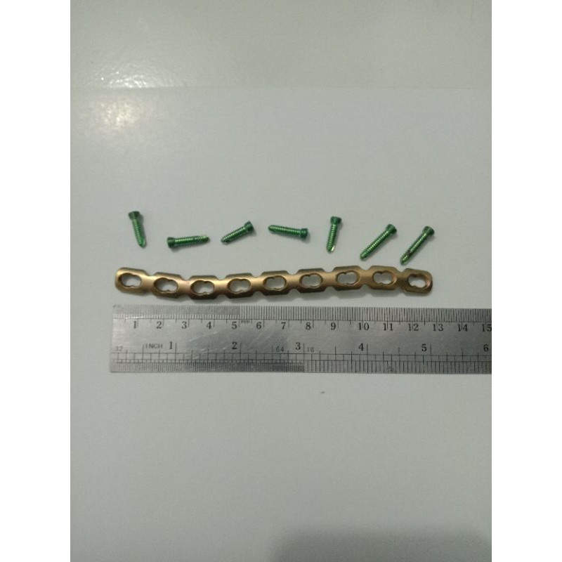 

besi pen selangka