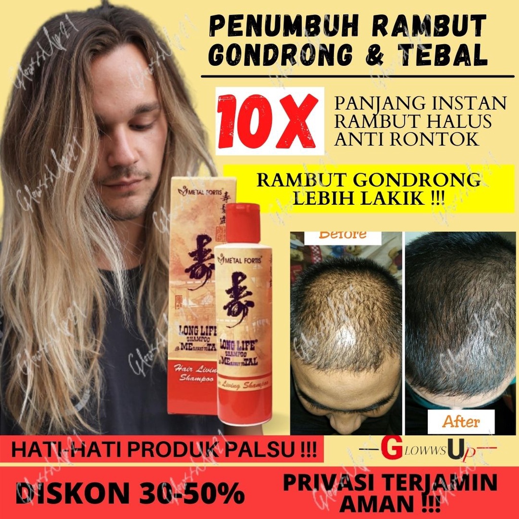 SHAMPOO METAL 100ML PENUMBUH RAMBUT PENYUBUR RAMBUT SHAMPOO METAL SAMPO METAL TREATMENT RAMBUT