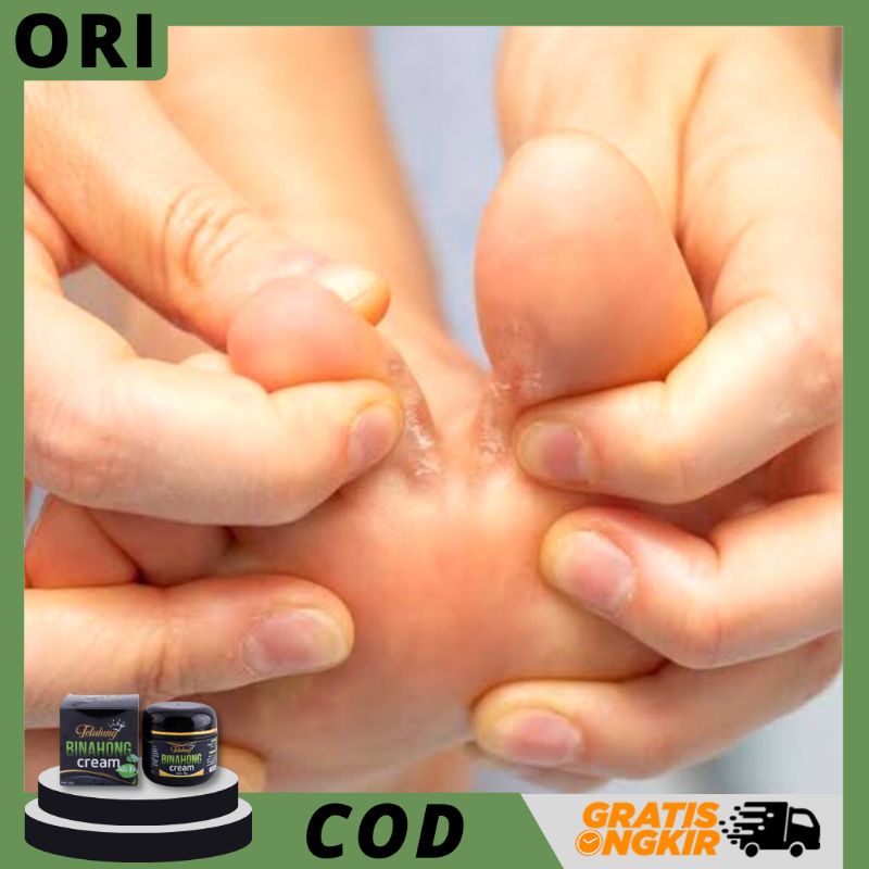 Cream Binahong 60 gr Obat Kutu Air Di Kaki Paling Ampuh - Obat Kutu Air Di Jari Jari Kaki dan Tangan