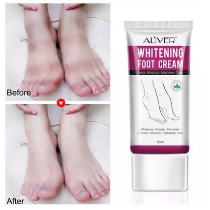 [COD] ALIVER WHITENING FOOT CREAM ORIGINAL PEMUTIH KULIT AMPUH DAN CEPAT