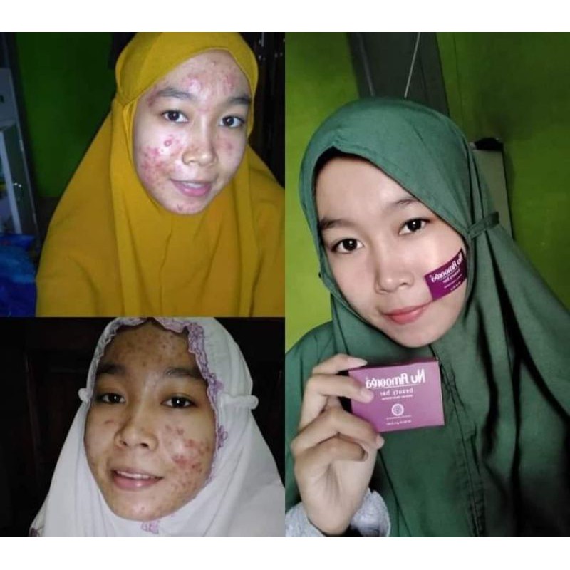 Nu Amoorea/Sabun Pencerah Wajah Pria Wanita/Sabun Kecantikan&Pengobatan/Sabun Glowing Wajah INSTAN S
