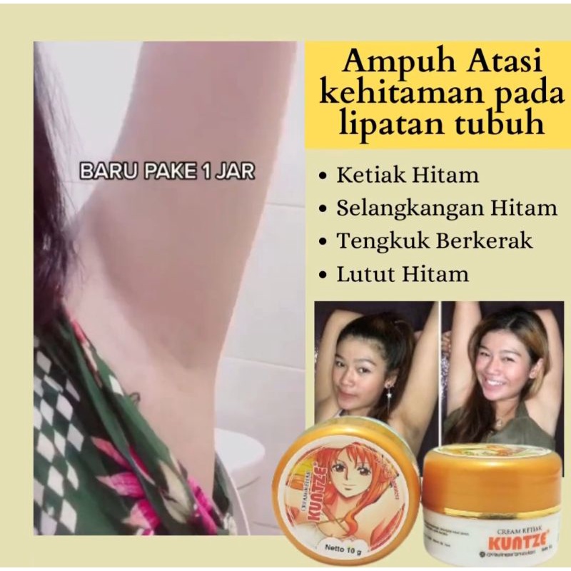 cream ketiak kuntze original bpom/pemutih ketiak selangkangan leher/pemutih kulit/shinkurim termurah