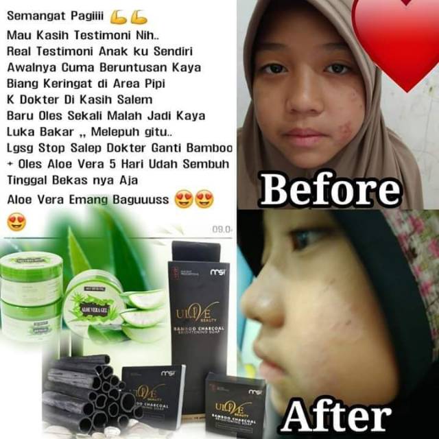 Manfaat Aloe Vera Msi Untuk Wajah