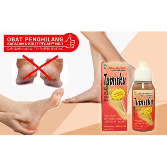 Tumitku Obat Herbal Kaki Pecah BPOM Original Asli Obat Kaki Kapalan 30ml Solusi Kaki Pecah Kapalan