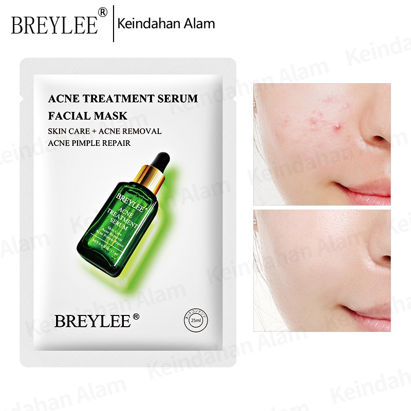 [Ori100%] Allphv Sheetmask Serum Mask Acne Treatment Vitamin C pemutih Pelembab Mengecilkan Poripori