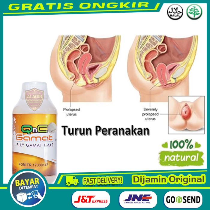 [ COD ] - Obat Turun Peranakan - Obat Turun Rahim, Polip Rahim, Tuba falopi Tersumbat - Jelly Gamat