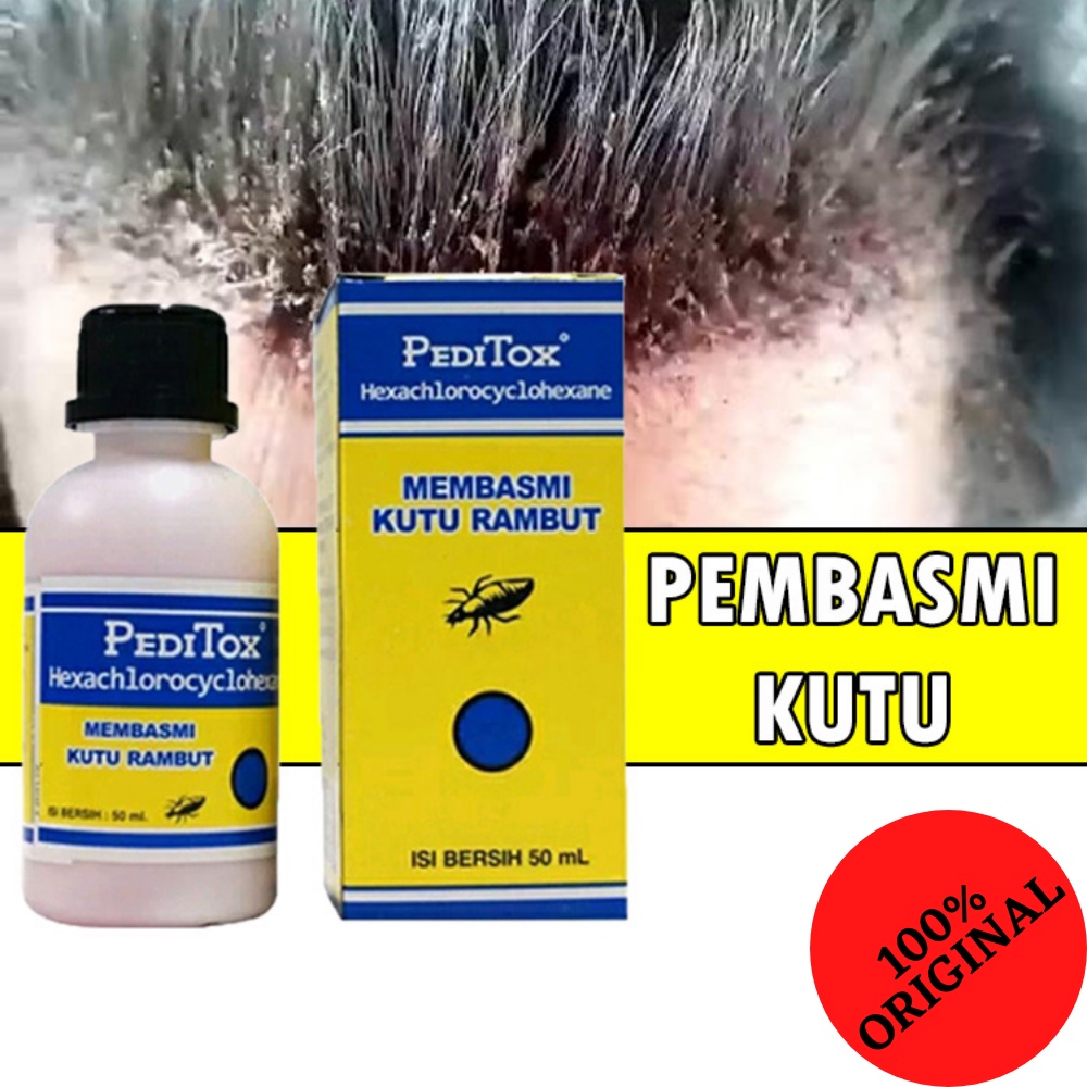 Obat Kutu Rambut Paling AMPUH PediTox / Pedi Tox 100% Original BPOM